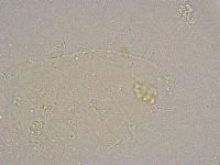 Pseudechiniscus suillus image