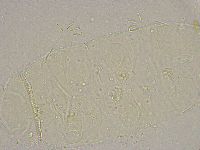 Pseudechiniscus suillus image