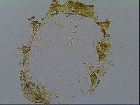 Macrobiotus hibiscus image