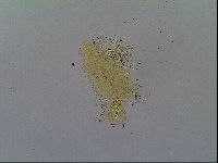 Mesobiotus furciger image