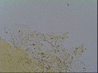 Mesobiotus furciger image