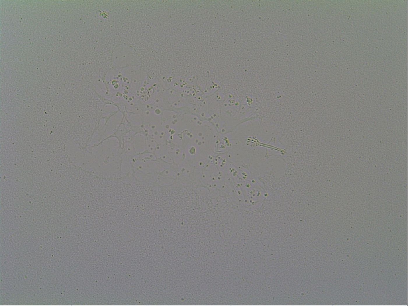 Minibiotus hispidus image