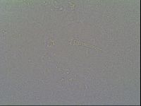 Minibiotus hispidus image