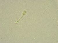 Minibiotus intermedius image
