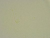 Minibiotus intermedius image
