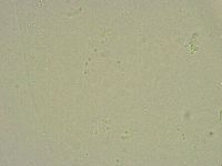 Minibiotus intermedius image