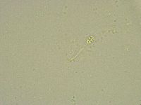 Minibiotus intermedius image