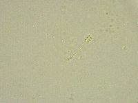 Minibiotus intermedius image