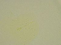 Minibiotus intermedius image