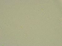 Minibiotus intermedius image