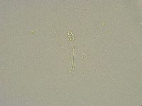 Minibiotus intermedius image