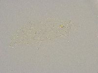 Minibiotus intermedius image