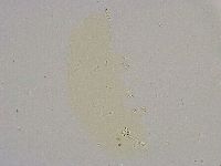 Minibiotus intermedius image
