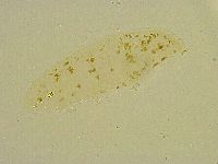 Minibiotus intermedius image