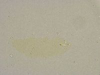 Minibiotus intermedius image