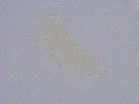 Minibiotus intermedius image