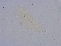 Minibiotus intermedius image