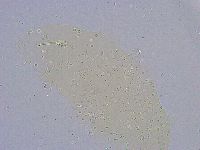 Minibiotus intermedius image