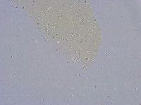 Minibiotus intermedius image