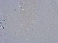 Minibiotus intermedius image