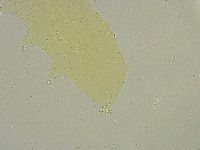 Minibiotus intermedius image