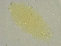 Minibiotus intermedius image