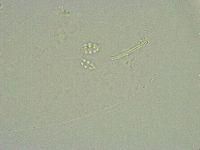 Minibiotus intermedius image