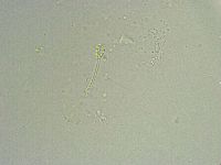 Minibiotus intermedius image