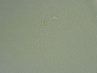 Minibiotus intermedius image