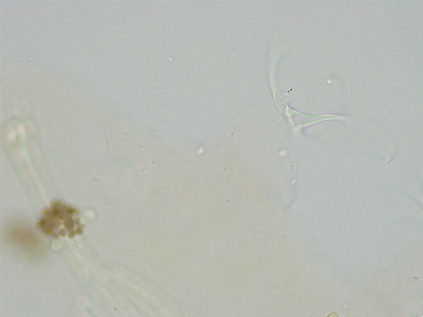 Pseudobiotus image