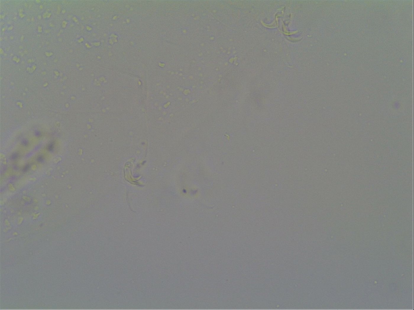 Schusterius tridigitus image