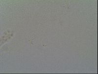 Schusterius tridigitus image