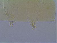 Mopsechiniscus schusteri image