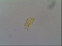 Mopsechiniscus schusteri image