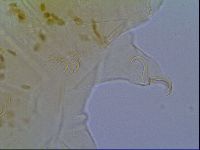 Mopsechiniscus schusteri image