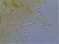 Mopsechiniscus schusteri image