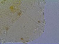 Mopsechiniscus schusteri image