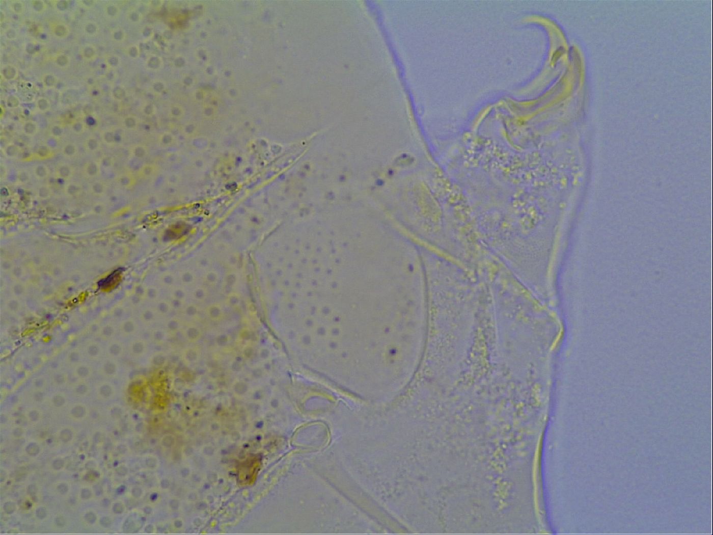 Mopsechiniscus schusteri image