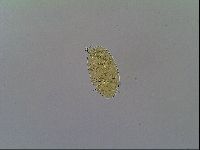 Mopsechiniscus schusteri image