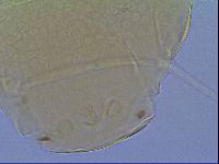 Mopsechiniscus schusteri image