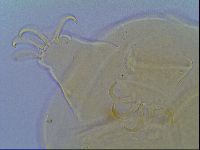 Mopsechiniscus schusteri image