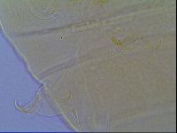 Mopsechiniscus schusteri image