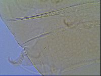 Mopsechiniscus schusteri image