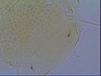 Mopsechiniscus schusteri image