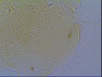 Mopsechiniscus schusteri image