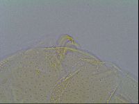 Mopsechiniscus schusteri image