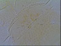 Mopsechiniscus schusteri image