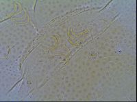 Mopsechiniscus schusteri image