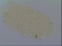 Mopsechiniscus schusteri image