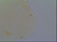 Mopsechiniscus schusteri image
